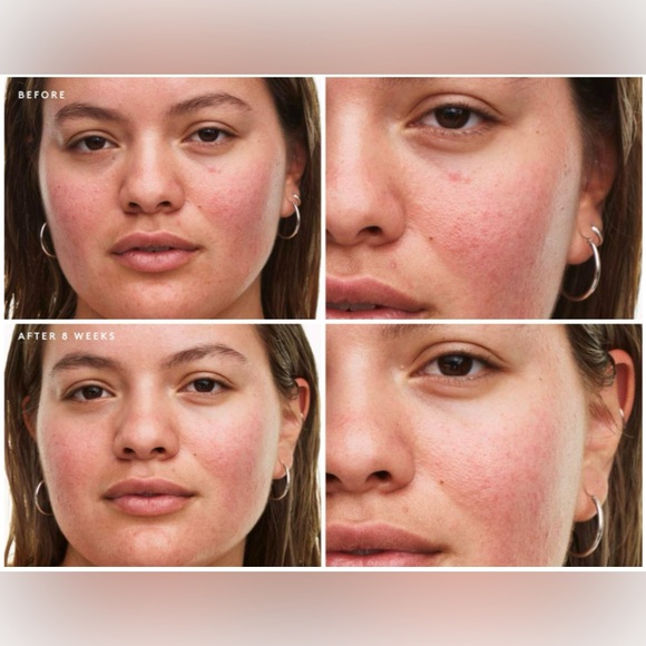 🌈2 for $100 🌈 Fenty Skin travel size start’s set: dry skin edition - Picture 4 of 8